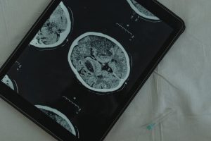 Esempi di Peptidi Promettenti
